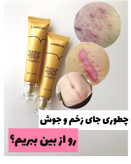 کرم ترمیم کننده لانبنا با لیبل اصلی مناسب جای بخیه و جای جوش