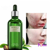 سرم چای سبز کنترل کننده چربی و جوش صورت مناسب پوست چرب و مختلط