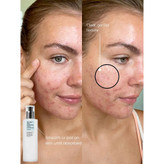 لوشن آبرسان مرطوب کننده اویل فری (فاقدچربی)اورجینال کره ای پوست چرب و مختلط با ضمانت اصل بودن کالا
