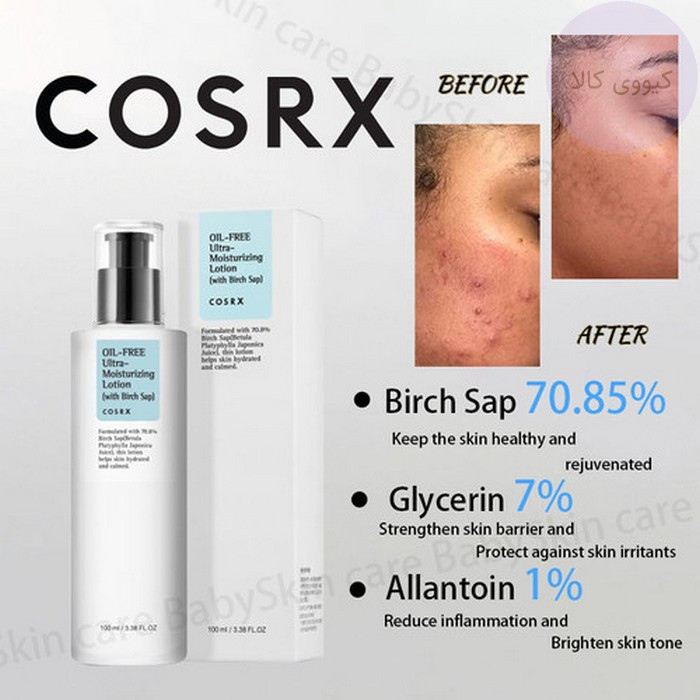 لوشن آبرسان مرطوب کننده اویل فری (فاقدچربی)اورجینال کره ای پوست چرب و مختلط با ضمانت اصل بودن کالا