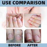 اسپری تقویت ناخن /رشد و ترمیم ناخن آسیب دیده اورجینال saedor