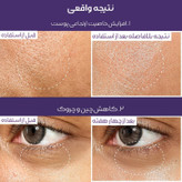 سرم ضد چروک قوی و بایولیفتینگ نامبوزین ۹ حاوی ++NAD و رتینول ساخت کره با ضمانت اصل بودن کالا