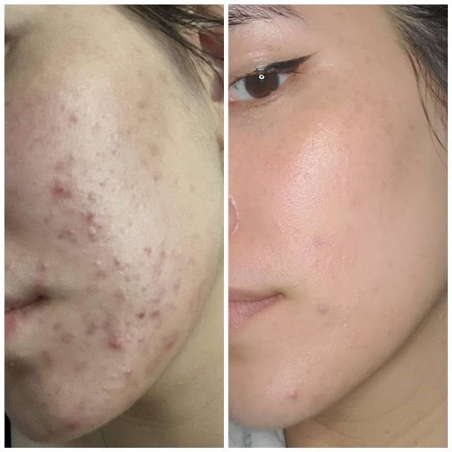 سرم ضدلک و روشن کننده اکسیییییسس وای✅️ مدل Dark Spot ساخت کره با ضمانت اصل بودن کالا