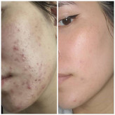 سرم ضدلک و روشن کننده اکسیییییسس وای✅️ مدل Dark Spot ساخت کره با ضمانت اصل بودن کالا