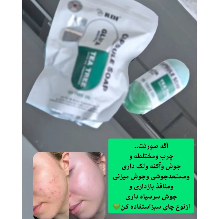 صابون درمانی سفید کننده گلوتاتیون کرهای ضد لک و کلاژن ساز