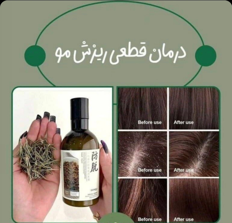 پک شامپو رزماری اورجینال + قطره رویش مجدد مو لانبنا+سرشور سیلیکونی با ضمانت اصل بودن کالا
