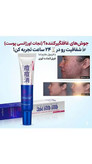 کرم ضدجوش قوی و ضد آکنه فوری بیوووو.اکواااا