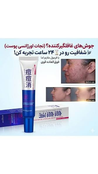 کرم ضدجوش قوی و ضد آکنه فوری بیوووو.اکواااا